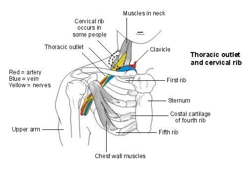 Cervical Rib Anomaly Differential Diagnosis Of Thoracic Outlet Syndrome